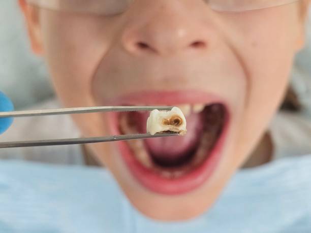 Best Broken or Cracked Tooth Emergency Dentist in Oakhurst, OK